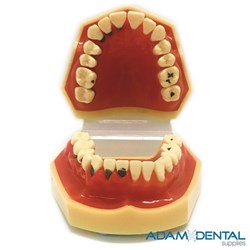 Gum Disease And Caries Dental/Education
