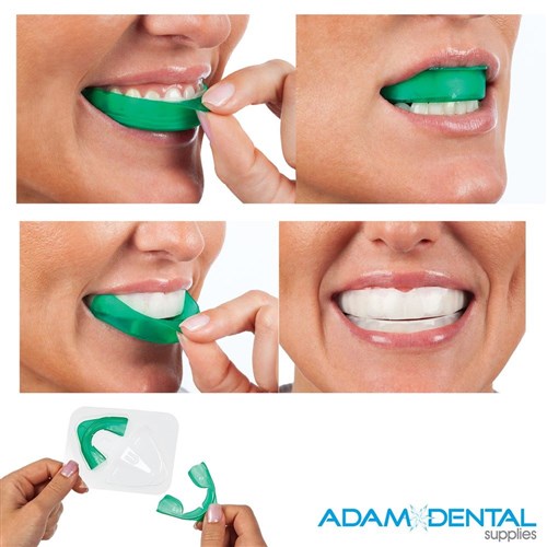 Opalescence GO Take Home Tooth Whitening