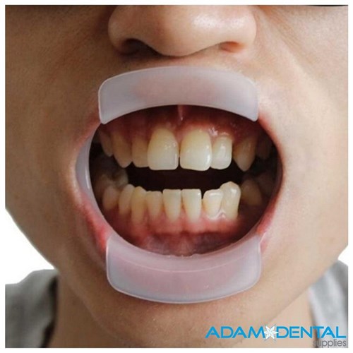 O Shaped Mouth Opener Retractor 10/pack