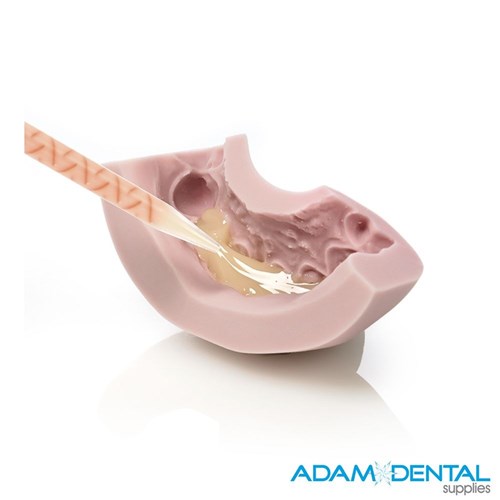 Zhermack Zetalabor Lab Putty 2.6 Kg & 1 Indurant 60ml Gel